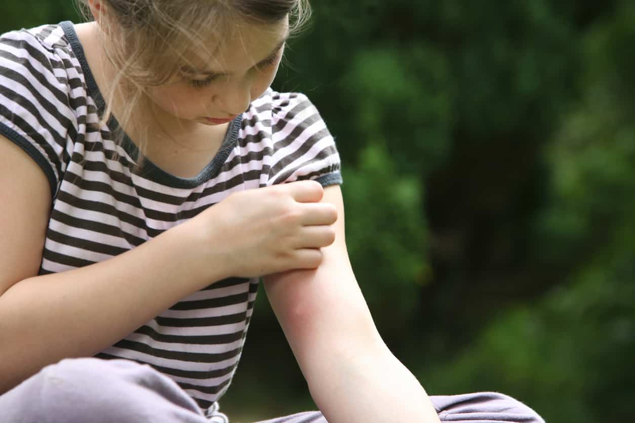 The Most Common Summer Illnesses Springborough Pharmasave